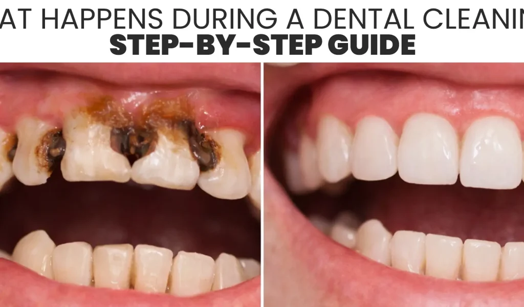 What Happens During a Dental Cleaning